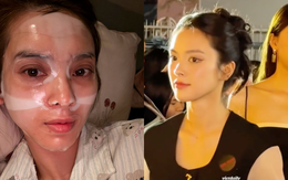 Bà chủ resort miền Tây từng khiến Tiểu Vy "out nét" khi đứng cạnh nay gặp kiếp nạn nhan sắc