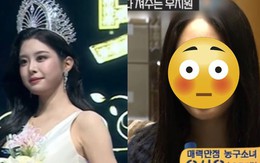 Hoa hậu bị "đào" loạt ảnh quá khứ, dân mạng chỉ trích "dao kéo" quá đà không xứng đăng quang!