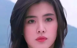 Biểu tượng nhan sắc lên tiếng về gương mặt biến dạng