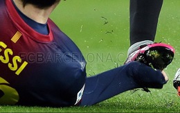 Messi bị giẫm "nát" tay