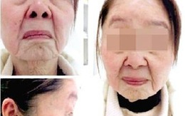 Trung Quốc: 28 tuổi nhìn như... cụ bà 80