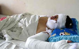 Cuối năm, chồng dùng xăng thiêu vợ