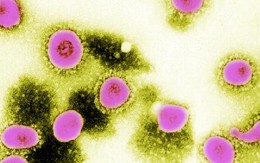 Xuất hiện chủng virus mới gây chết người