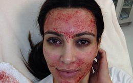 Kim "siêu vòng 3" làm đẹp da mặt bằng... máu người