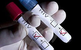 Hành trình chế ngự virus HIV