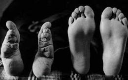 Những cách làm đẹp nguy hiểm thời xa xưa