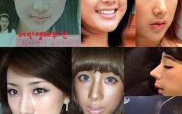 “Biểu tượng thời trang” xứ Hàn thừa nhận phẫu thuật mũi