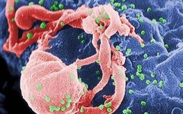 Những điều ít biết về HIV/AIDS