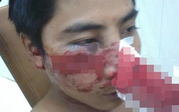 Sốc trong tuần: 141 Hà Nội bị "tố" đánh người vỡ quai hàm