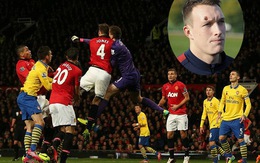 Mặt Phil Jones xưa đã kỳ nay còn dị