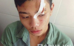Nghệ An: Đang ăn cơm, côn đồ lao vào nhà đập phá, chém người