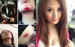 Chấn thương kinh hoàng của nữ tay đua xinh đẹp Đài Loan