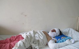 Ghen tuông, chồng tưới xăng đốt vợ