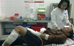 Hà Nội: Nửa đêm đem xăng thiêu người, hung thủ bỏng nặng