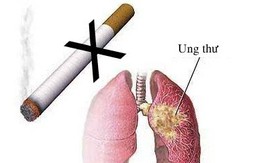 9 bệnh ung thư người hút thuốc lá có nguy cơ mắc phải