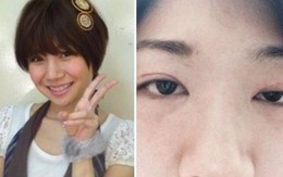 Nữ diễn viên Nhật mặt biến dạng sau khi treo cổ tự sát