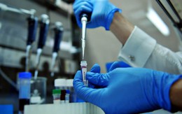 Tìm ra cách mới chữa HIV