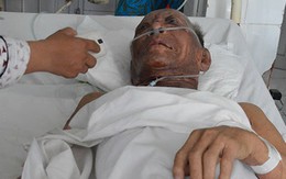 Mẹ già đau đớn kể chuyện con trai đổ xăng đốt cha