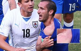 Bản tin World Cup: Chiellini nói gì về Suarez?