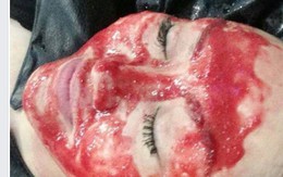 Ảnh Phi Thanh Vân làm đẹp bằng máu gây sốc