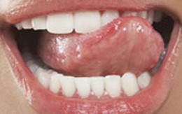 11 biểu hiện của lưỡi chứng tỏ bạn có bệnh trong người