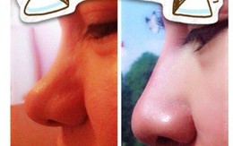 Hoảng hồn tiêm “thần dược” làm đẹp chui tại Hà Nội