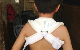 Đà Nẵng: Một thanh niên 80kg đánh cháu bé 13 tuổi nứt xương vai?