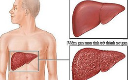 Bài thuốc 8 đời "cải tử hoàn sinh" hàng trăm người mắc bệnh nan y