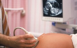Nhức nhối vụ thai nhi 8 tháng tuổi bị chính quyền ép phá bỏ