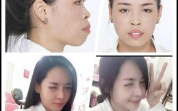 Sửng sốt trước sự thay đổi diện mạo xinh đẹp của cô gái Nam Định