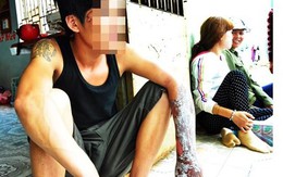 Đến nói chuyện, bị đối thủ tạt xăng thiêu sống
