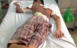 Truy bắt nhóm người đánh ghen bằng xăng