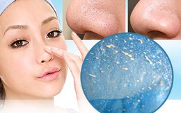 Cách trị mụn đầu đen hiệu quả mà không cần đến spa