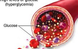 Bạn có thể bị tiểu đường nếu có dấu hiệu này mà không khám ngay