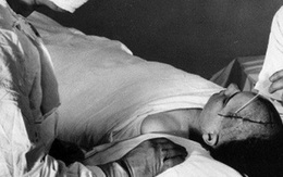 Kinh hãi 5 biện pháp chữa bệnh ‘sởn gai ốc’ đầu thế kỷ XX