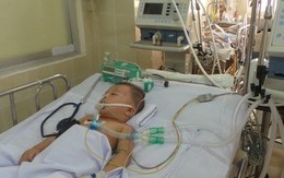 Rơi từ tầng 2, bé trai 2 tuổi hôn mê sâu