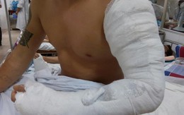 Hà Nội: Từ chối chơi cờ tướng, nam thanh niên bị chém đứt cơ tay
