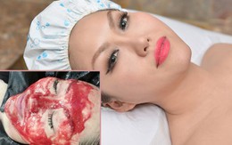 Sao Việt cuốn băng dính, tự tát vào mặt... để làm đẹp