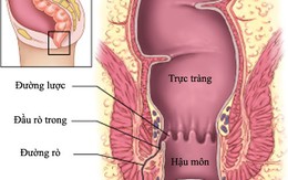 Căn bệnh “oái oăm” khiến cơ thể bốc mùi khó ngửi