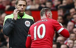 CLIP: Rooney đổ máu tại Old Trafford