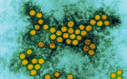 Virus mới gây ra tình trạng tê liệt ở trẻ em trên nước Mỹ