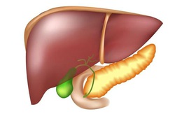 Nôn mửa dịch màu xanh cảnh báo bệnh gì?