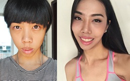 Đọc bài này xong, bạn sẽ thấy niềng răng chính là phương pháp làm đẹp hiệu quả nhất!