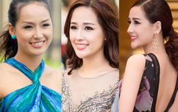 13 chiếc cằm "thị phi" của showbiz Việt