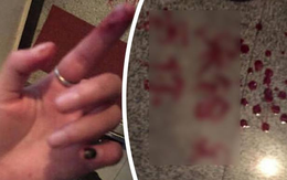 Cô gái trẻ gửi thư tình bằng máu khiến chàng trai sợ xanh mặt