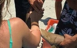 Cá mập ngoạm tay cô gái không rời dù bị lôi lên bờ
