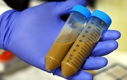 ‘Ngân hàng phân người’ tại Hà Lan