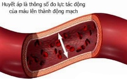 48% dân số Việt Nam mắc bệnh cao huyết áp