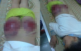 Phẫn nộ hình ảnh con 13 tuổi ở Thái Nguyên bị bố đánh tứa máu