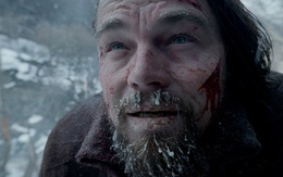 Chuyên gia y tế giải thích vì sao nhân vật do Leonardo DiCaprio thủ vai trong Revenant vẫn sống sót ngoài đời thực